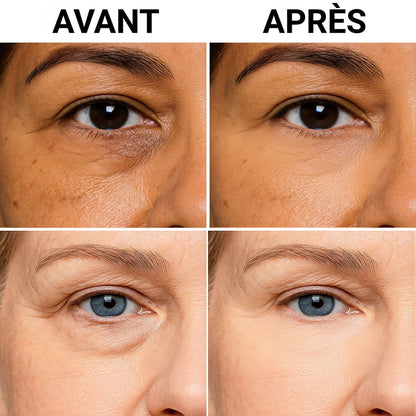 UNDER EYE BRIGHTENER 2EN1 BY NYMEA - Adapté Peaux Sensibles